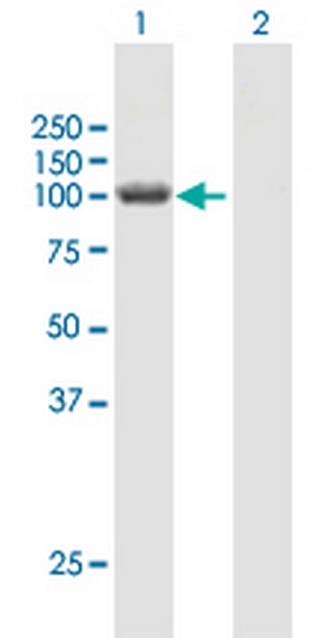 HERC3 Antibody in Western Blot (WB)