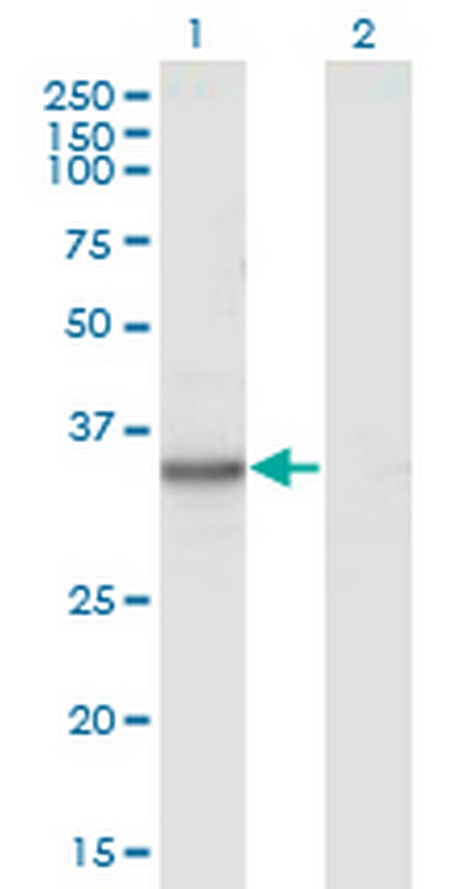 KYNU Antibody in Western Blot (WB)