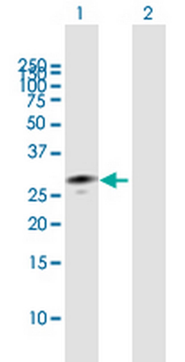 MPZL1 Antibody in Western Blot (WB)