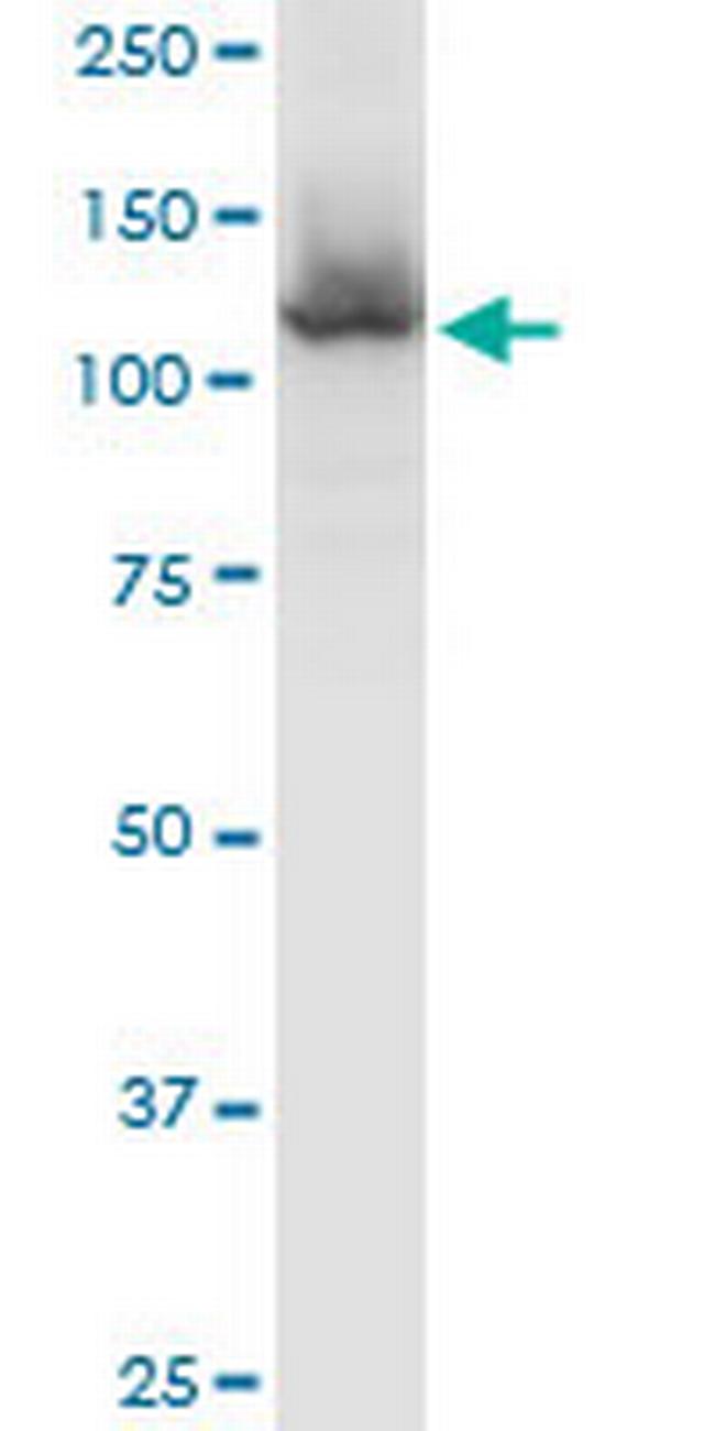 HIP1R Antibody in Western Blot (WB)