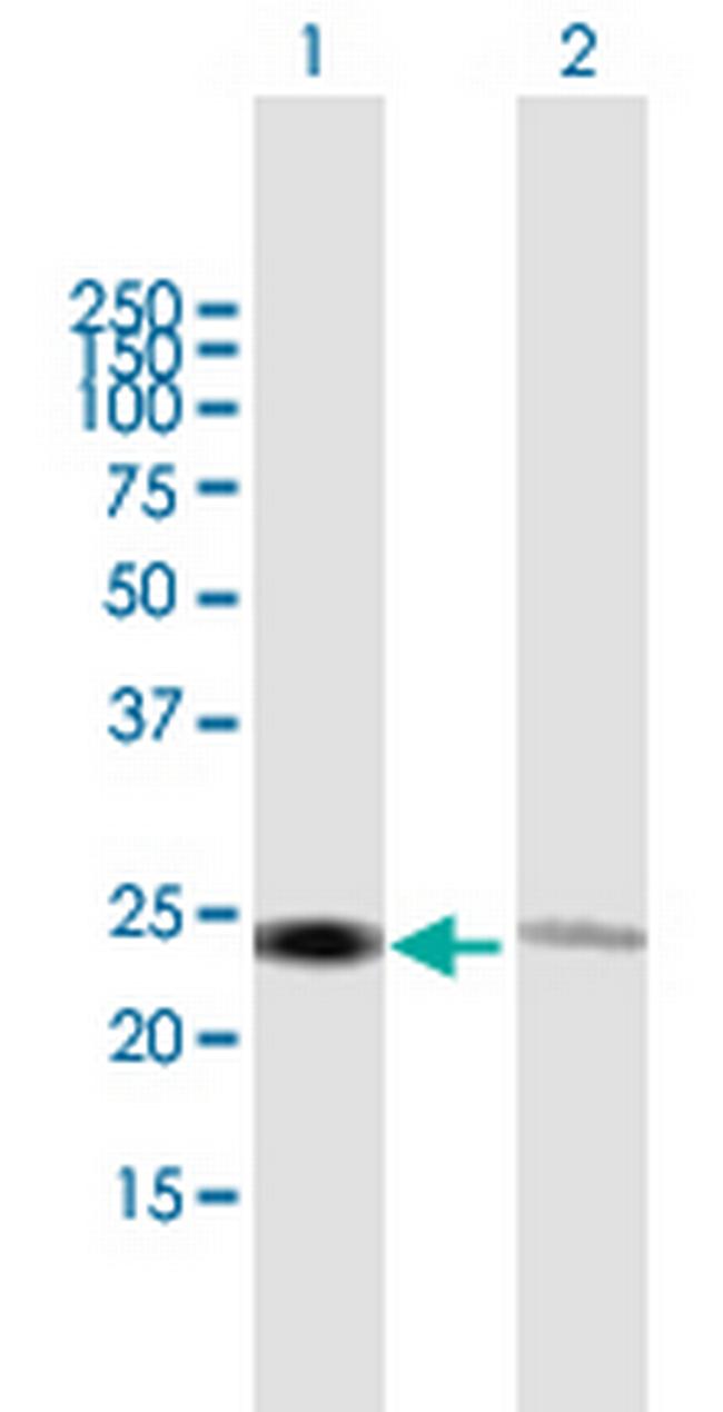 RPL14 Antibody in Western Blot (WB)