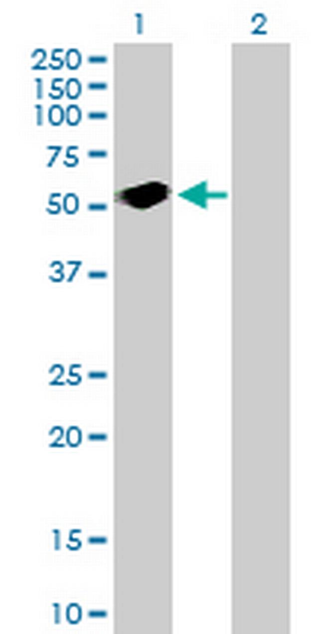 SH2D2A Antibody in Western Blot (WB)