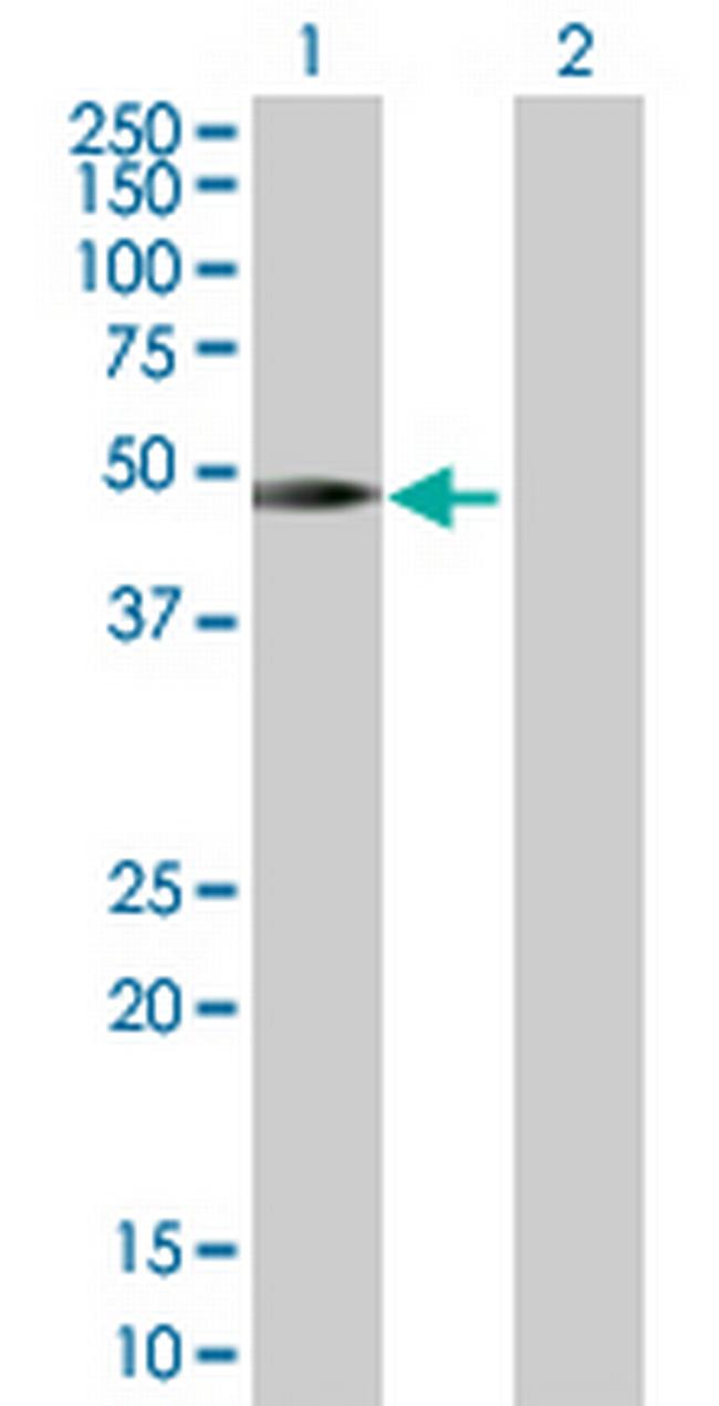 SH2D2A Antibody in Western Blot (WB)