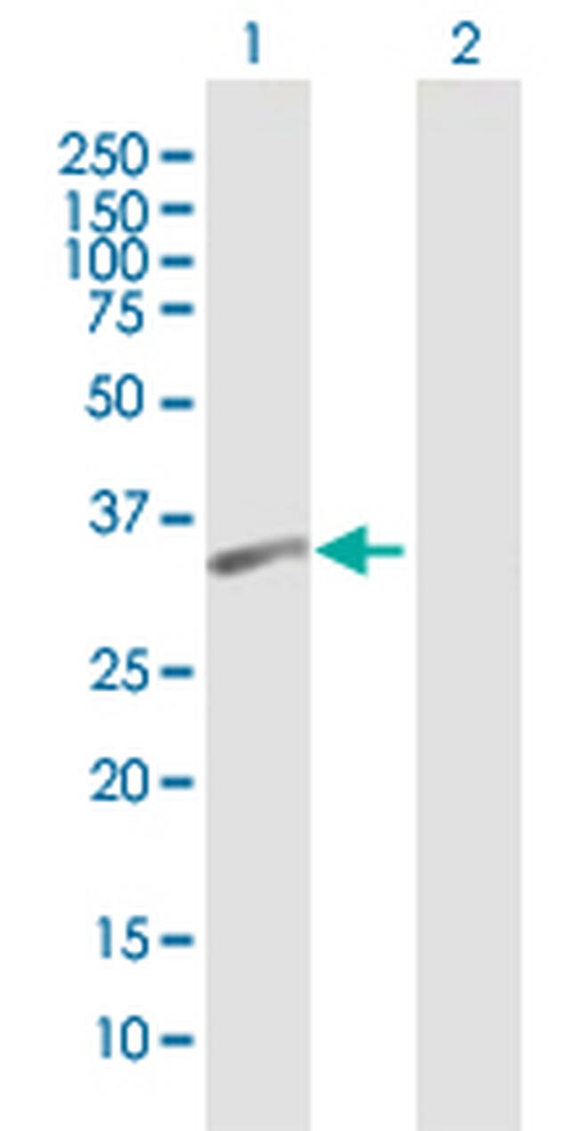 PSTPIP2 Antibody in Western Blot (WB)