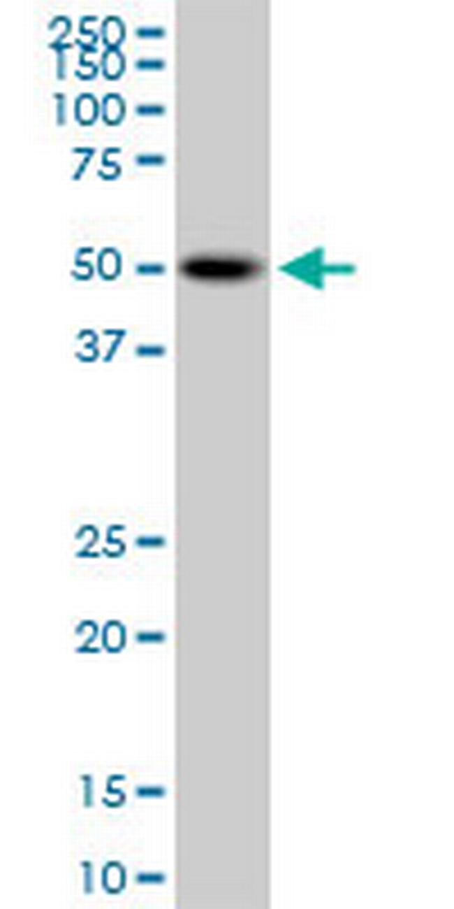 PSTPIP1 Antibody in Western Blot (WB)