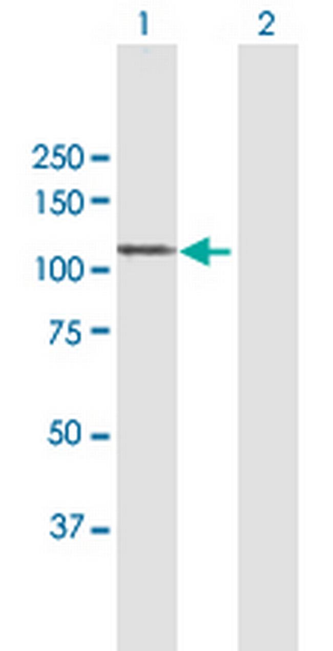 MAP7 Antibody in Western Blot (WB)