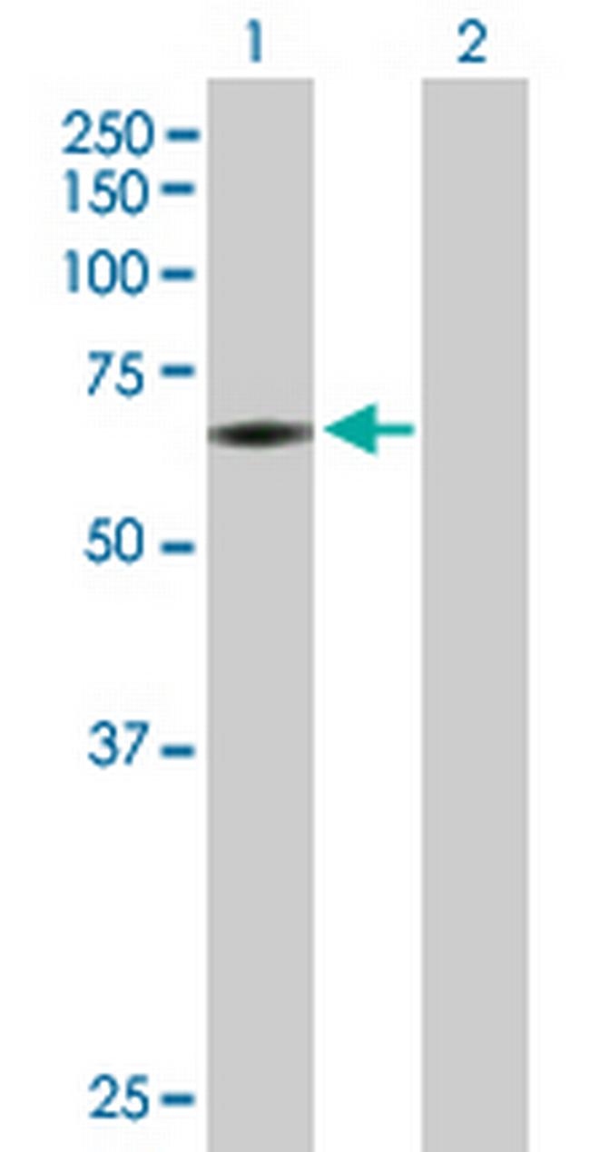 PAPSS2 Antibody in Western Blot (WB)