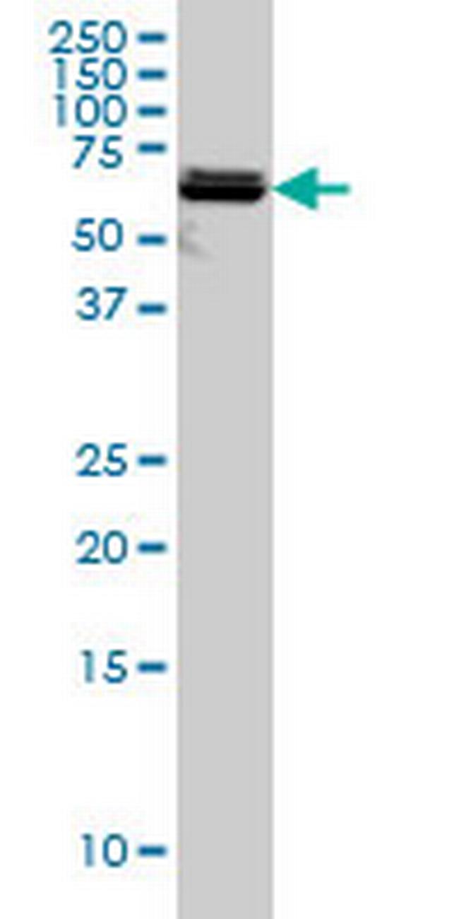 PAPSS2 Antibody in Western Blot (WB)