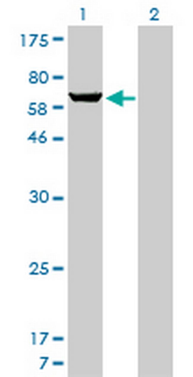 PAPSS1 Antibody in Western Blot (WB)