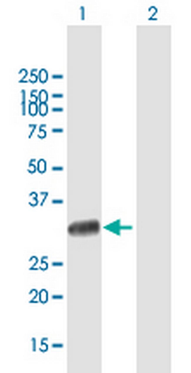 UNC119 Antibody in Western Blot (WB)