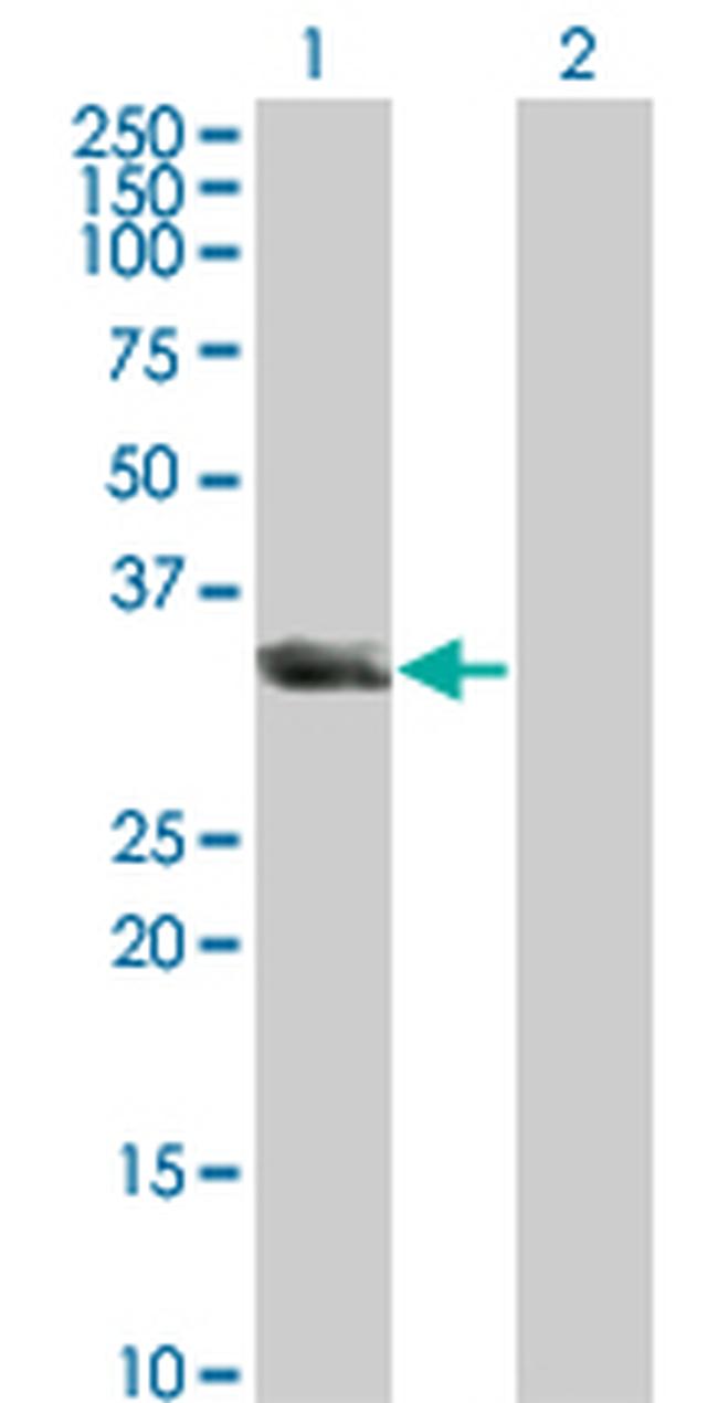 UNC119 Antibody in Western Blot (WB)
