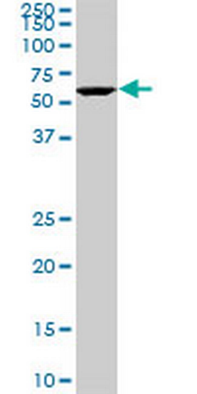USP14 Antibody in Western Blot (WB)