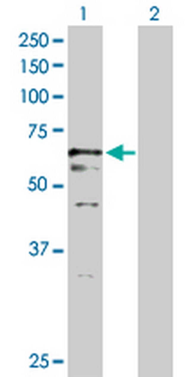 USP2 Antibody in Western Blot (WB)