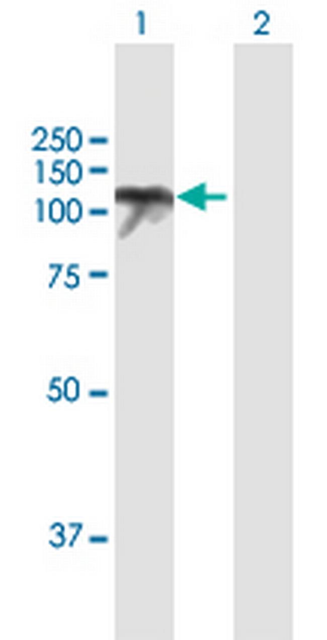 USP10 Antibody in Western Blot (WB)