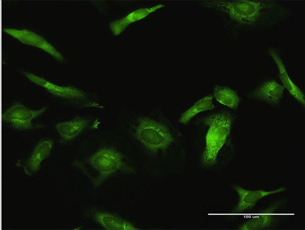 USP10 Antibody in Immunocytochemistry (ICC/IF)