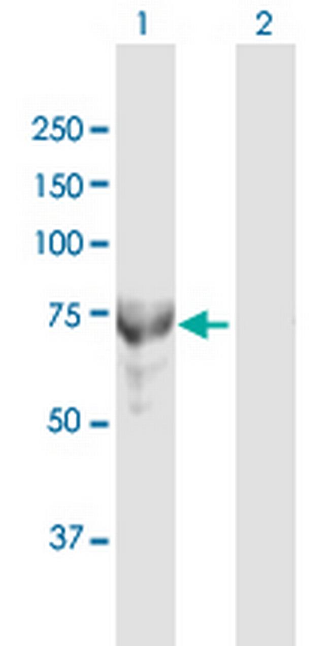 MTMR6 Antibody in Western Blot (WB)