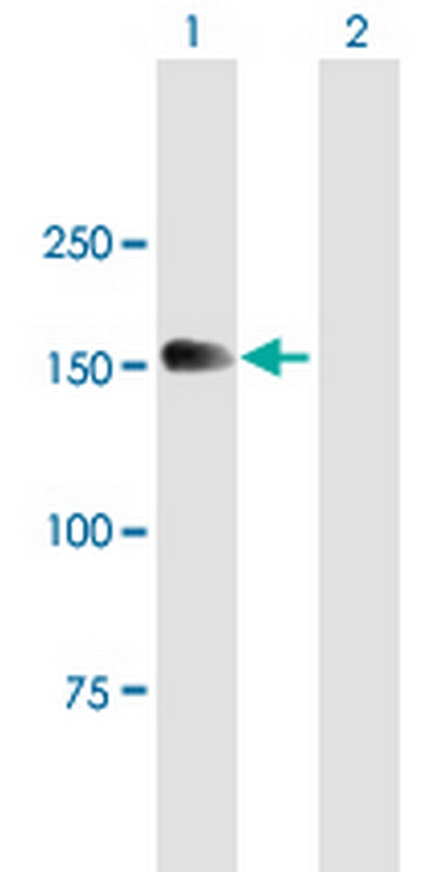 MTMR4 Antibody in Western Blot (WB)