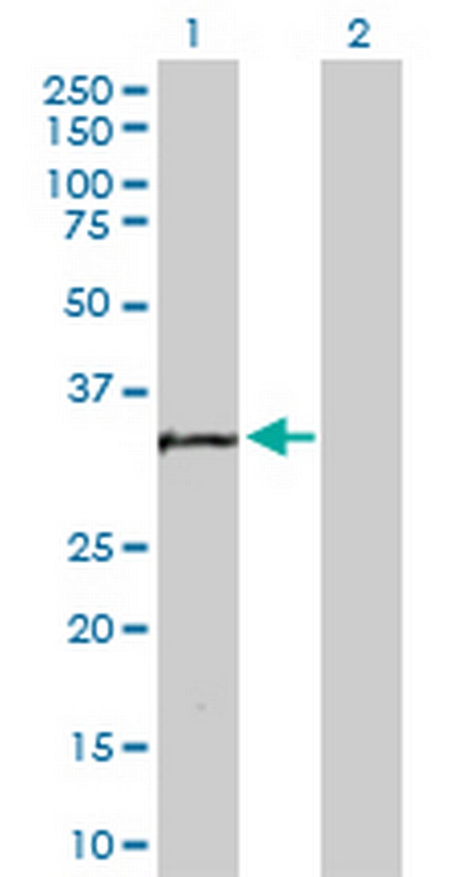 MTA1 Antibody in Western Blot (WB)