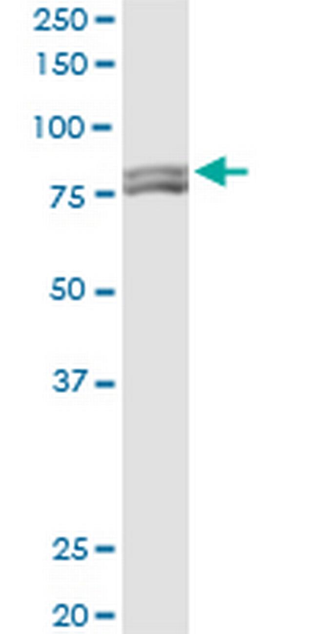 MTA1 Antibody in Western Blot (WB)