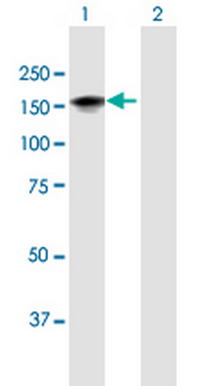LATS1 Antibody in Western Blot (WB)