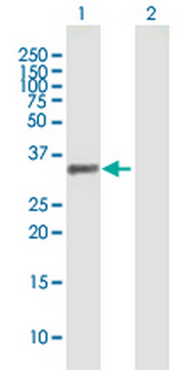 PDLIM1 Antibody in Western Blot (WB)