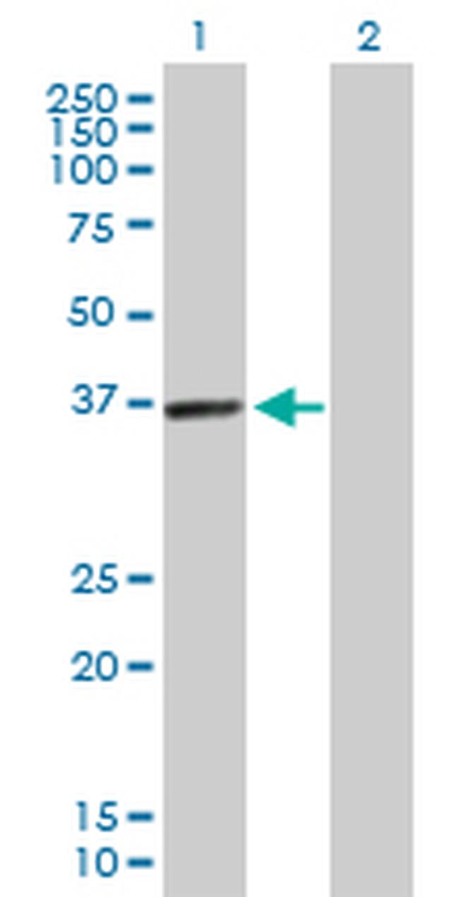 PDLIM1 Antibody in Western Blot (WB)