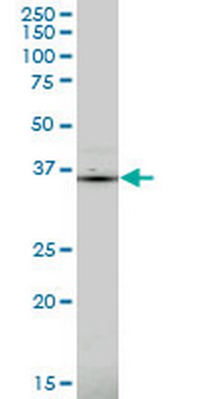 PDLIM1 Antibody in Western Blot (WB)