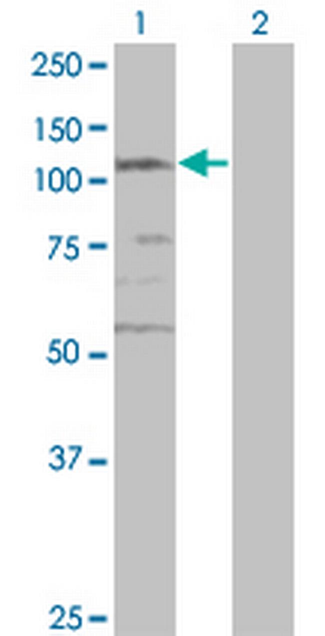 CSPG6 Antibody in Western Blot (WB)