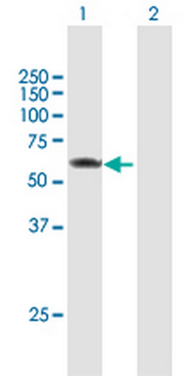 PRPF4 Antibody in Western Blot (WB)
