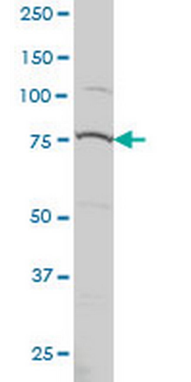 PRPF3 Antibody in Western Blot (WB)