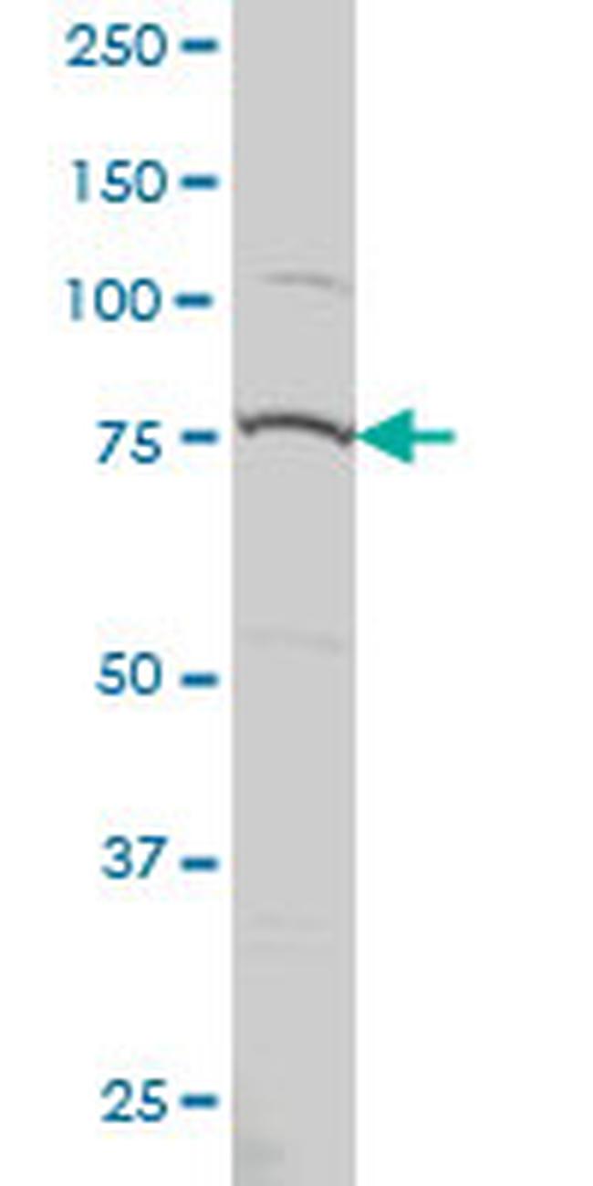 PRPF3 Antibody in Western Blot (WB)