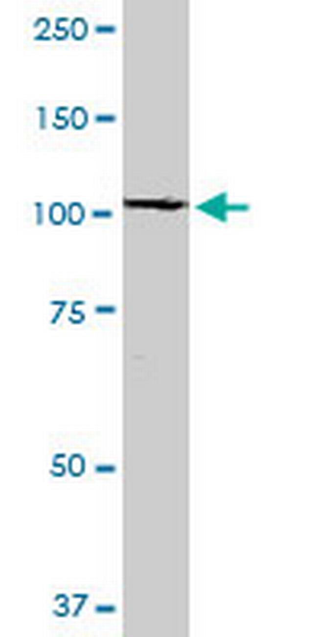 RABEP1 Antibody in Western Blot (WB)