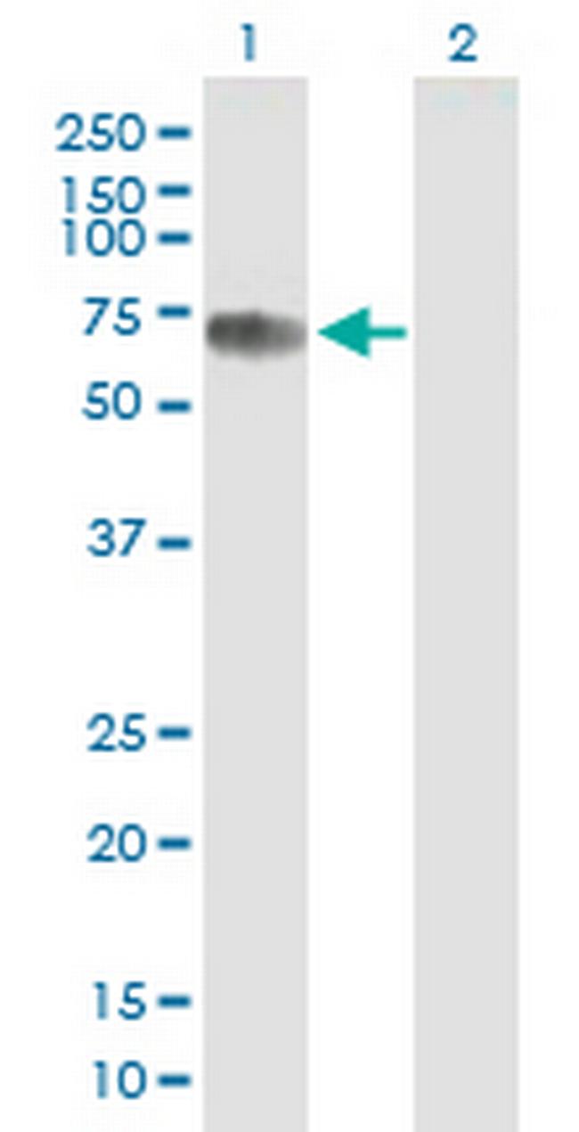 CBFA2T2 Antibody in Western Blot (WB)
