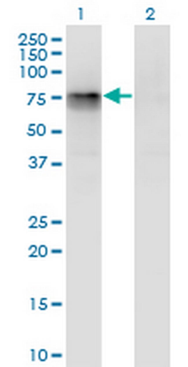 CBFA2T2 Antibody in Western Blot (WB)