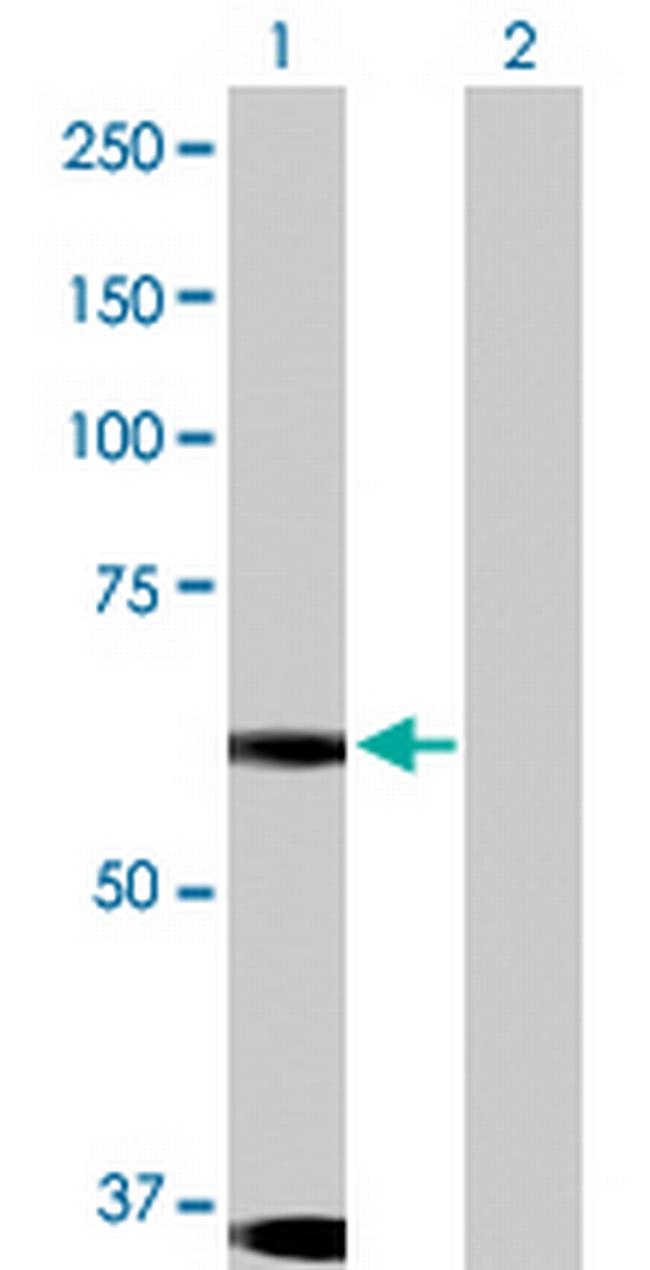 DYRK1B Antibody in Western Blot (WB)