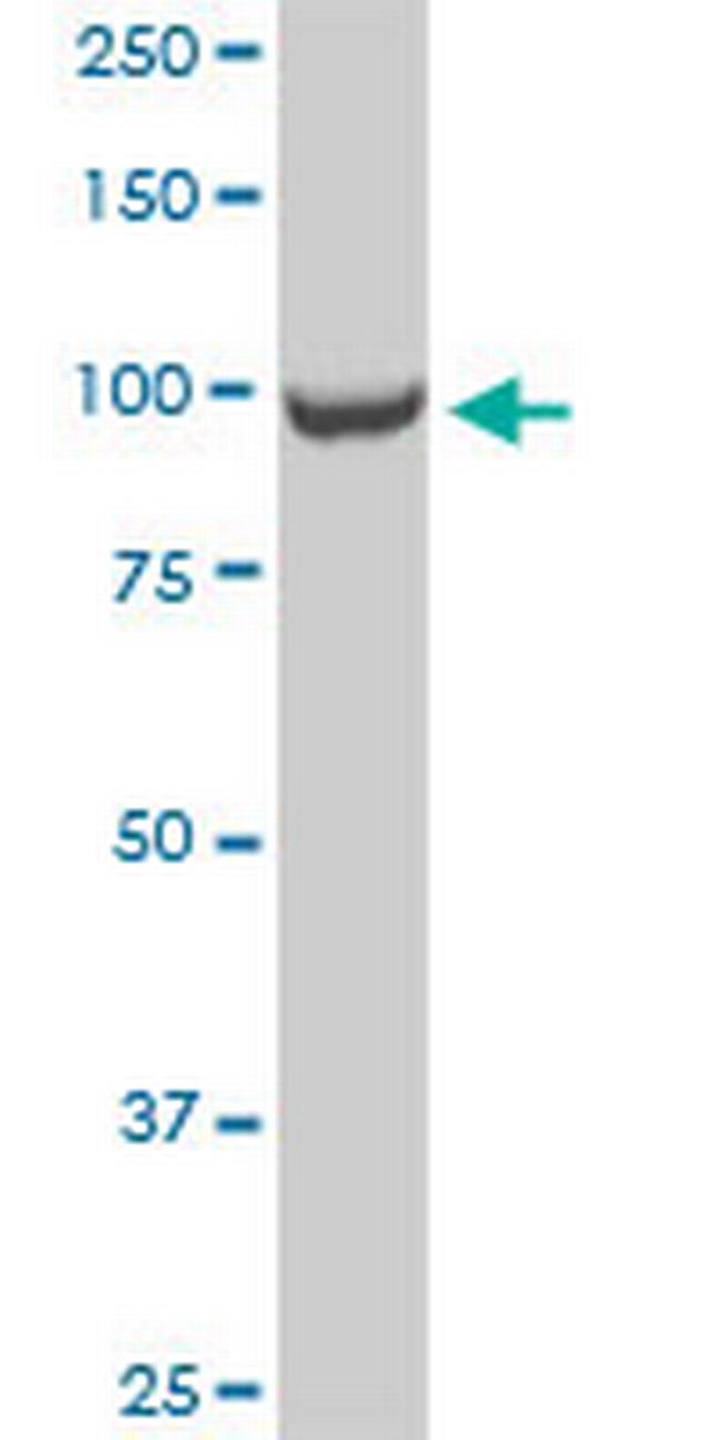 CTDP1 Antibody in Western Blot (WB)