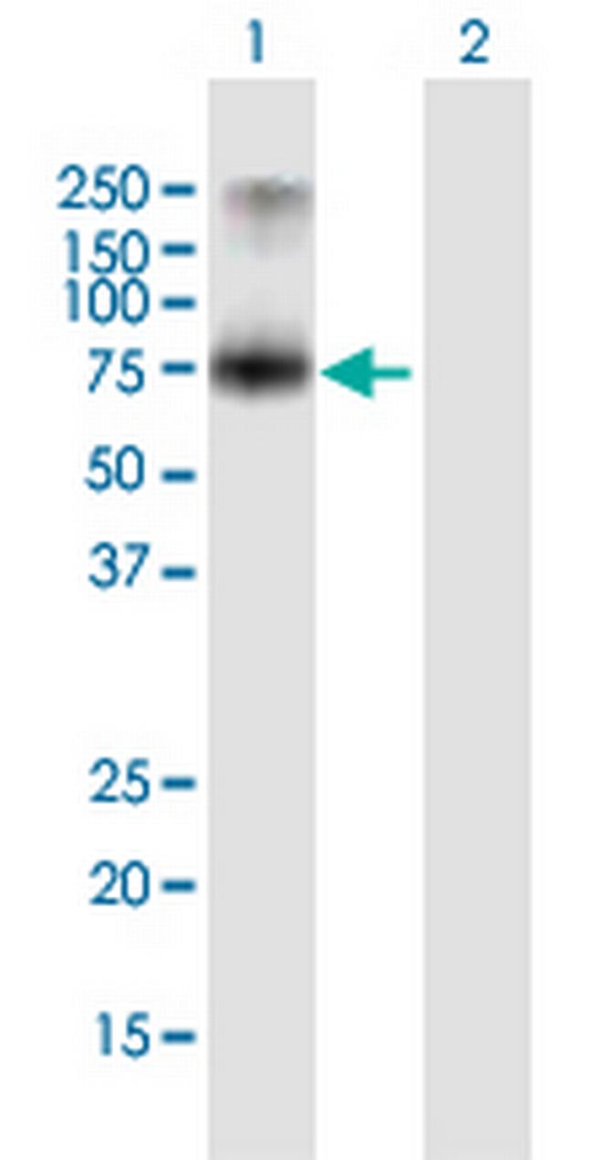 PCSK7 Antibody in Western Blot (WB)