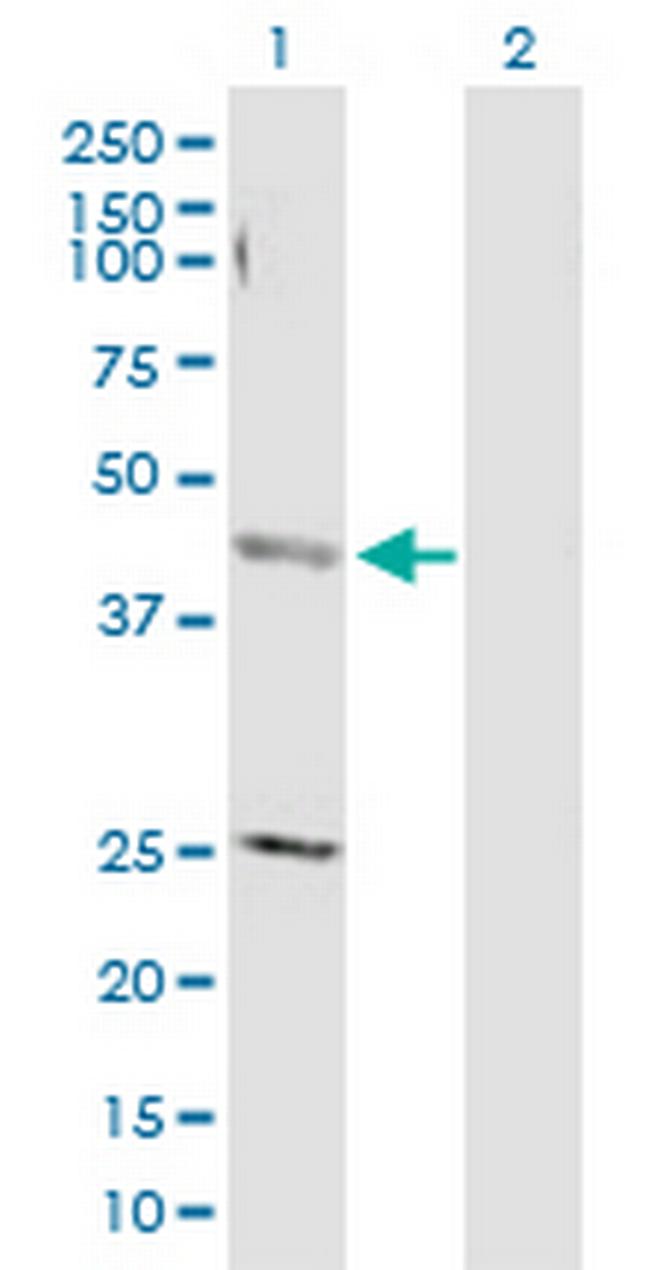AP4M1 Antibody in Western Blot (WB)