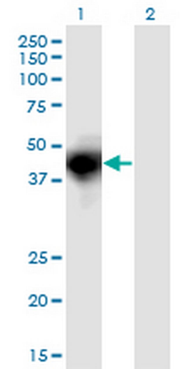 OSMR Antibody in Western Blot (WB)