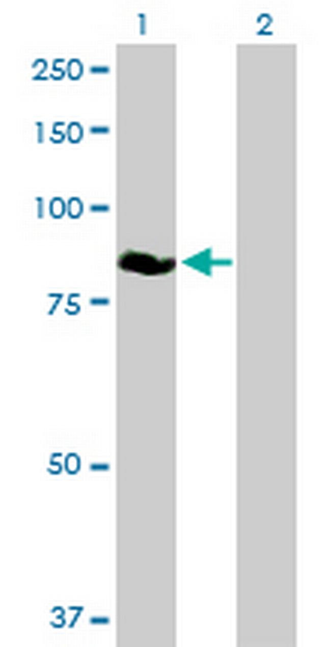 ZBED1 Antibody in Western Blot (WB)