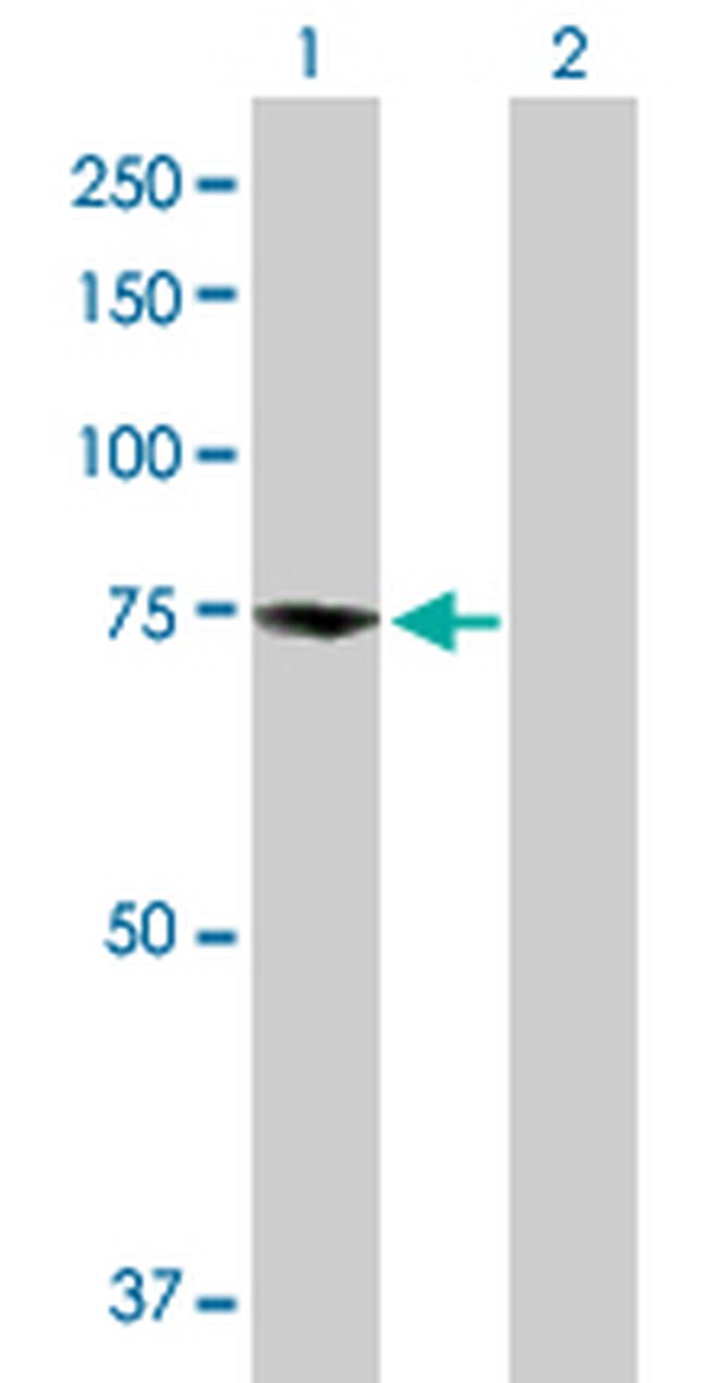 ZBED1 Antibody in Western Blot (WB)