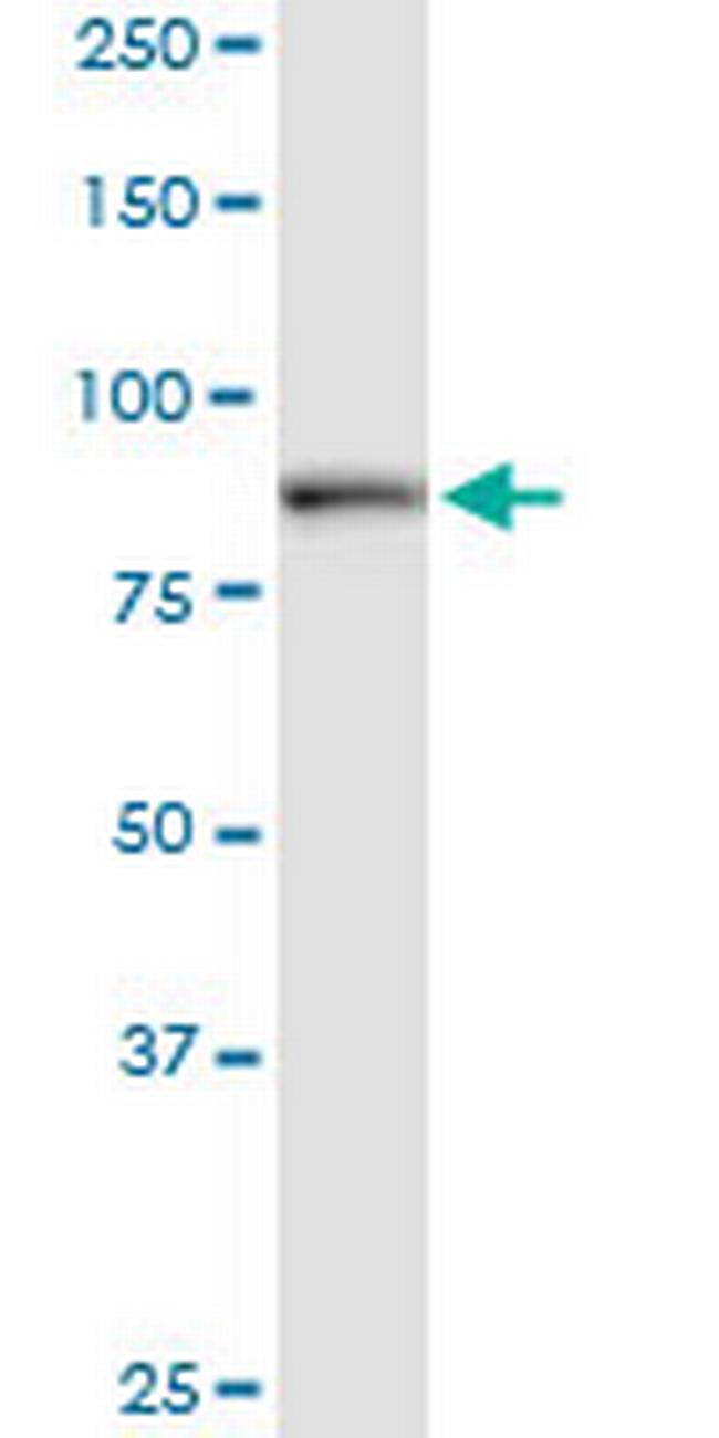 DCAMKL1 Antibody in Western Blot (WB)