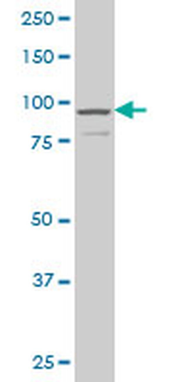 DCAMKL1 Antibody in Western Blot (WB)