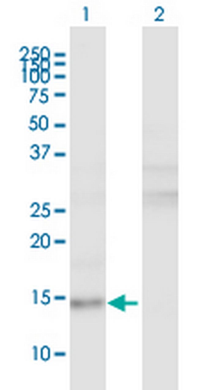 LRRFIP1 Antibody in Western Blot (WB)