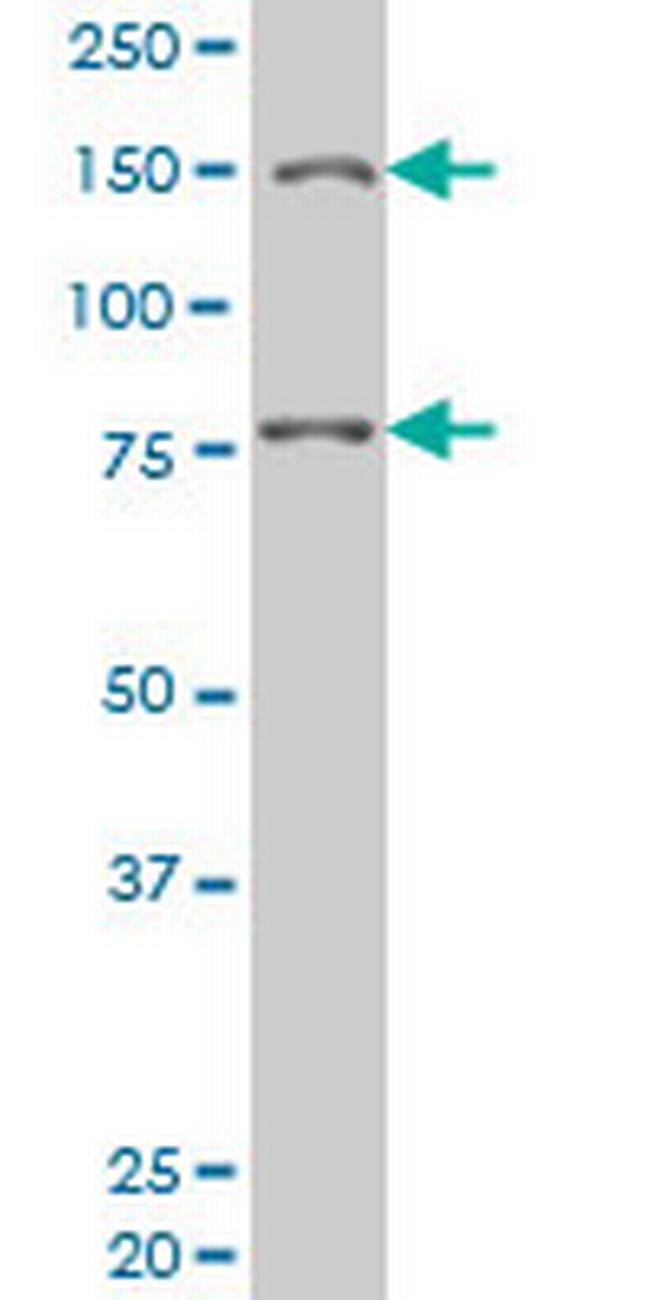 LRRFIP1 Antibody in Western Blot (WB)