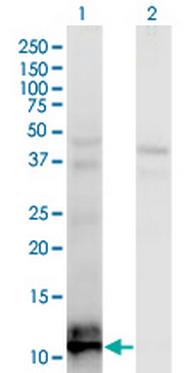 TIAF1 Antibody in Western Blot (WB)