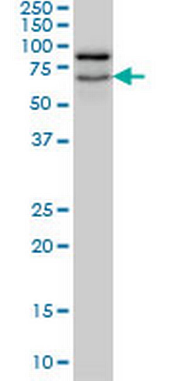 NOLC1 Antibody in Western Blot (WB)