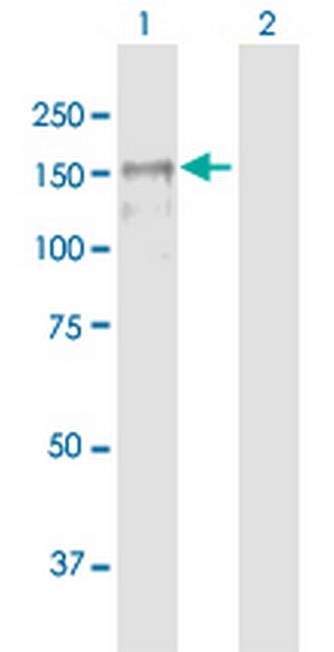 MAGI1 Antibody in Western Blot (WB)