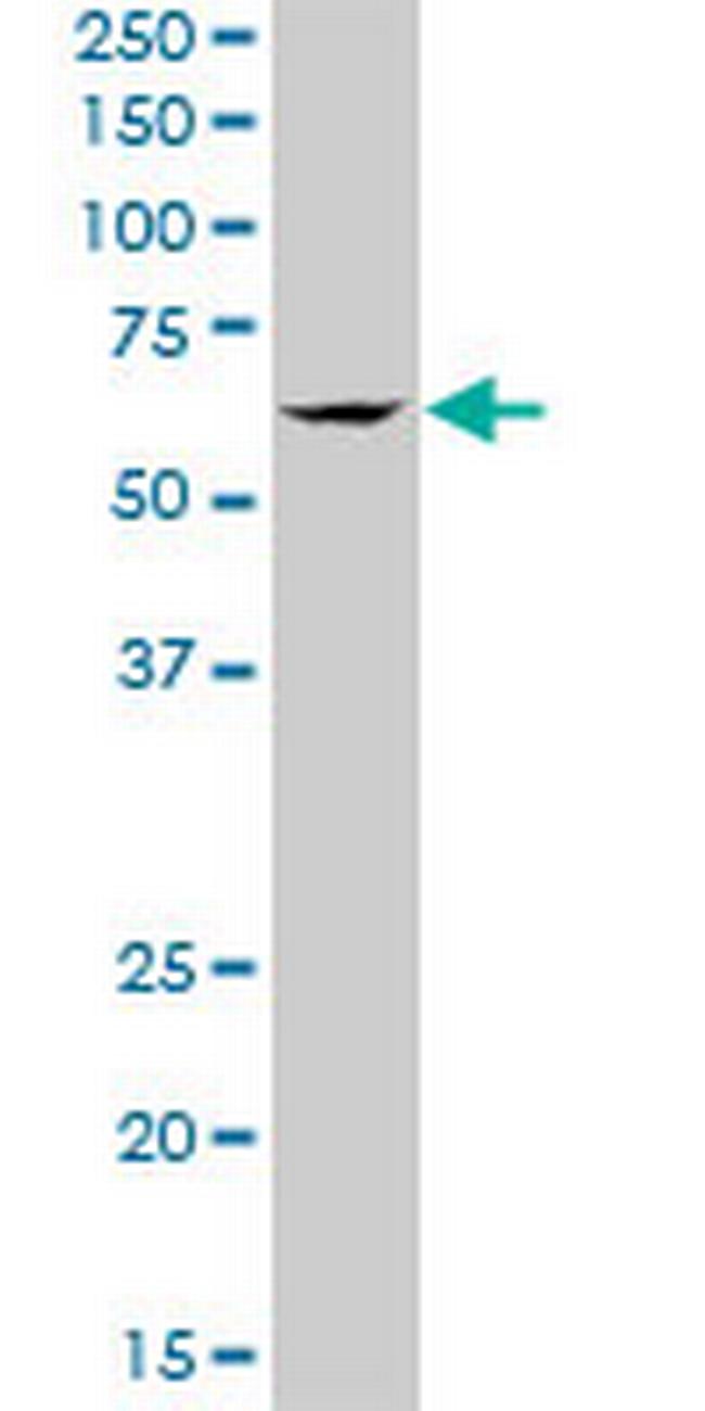 TBRG4 Antibody in Western Blot (WB)