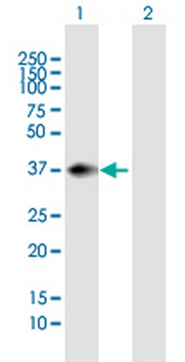 PNMA1 Antibody in Western Blot (WB)
